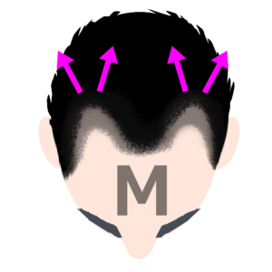 M字型うす毛