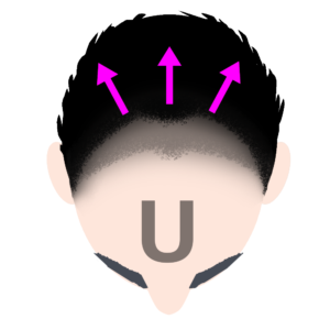 U字型うす毛